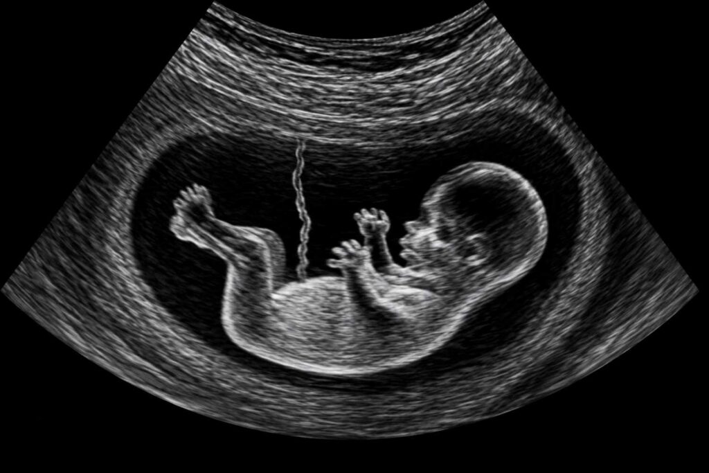NT Scan in Dwarka - RNK Diagnostics