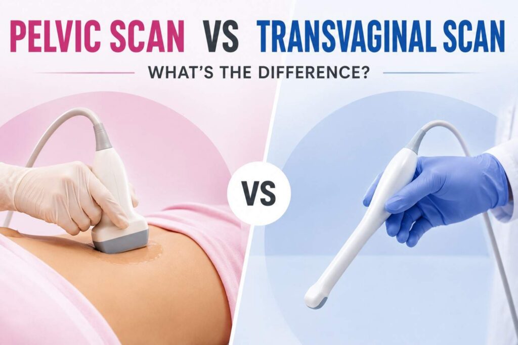 Pelvic Scan vs Transvaginal Scan